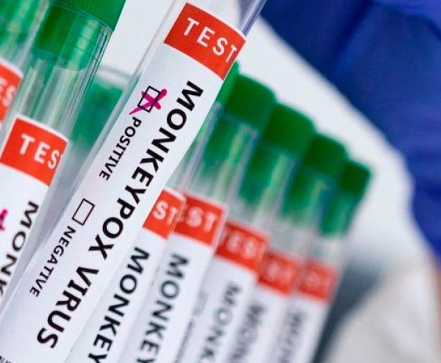 Dois casos de var&iacute;ola dos macacos s&atilde;o confirmados em Rond&ocirc;nia &ndash; A P&Eacute;ROLA DO  MAMOR&Eacute;